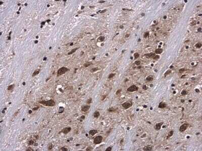 Immunohistochemistry-Paraffin: Ribosomal Protein S6/RPS6 [p Ser235] Antibody [NBP3-13078]